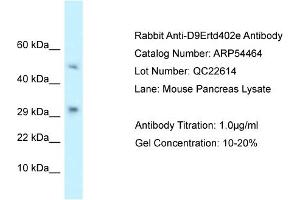 Western Blotting (WB) image for anti-T Cell Activation Inhibitor, Mitochondrial (TCAIM) (N-Term) antibody (ABIN2785726) (TCAIM antibody  (N-Term))