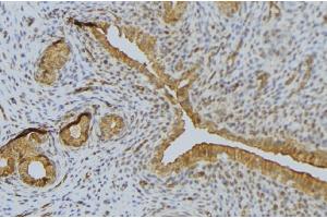 ABIN6276635 at 1/100 staining Human uterus tissue by IHC-P.