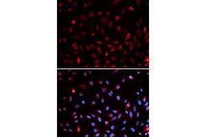 Immunofluorescence analysis of U2OS cells using ERCC1 antibody (ABIN5973037). (ERCC1 antibody)