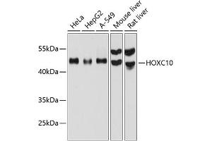 Western blot analysis of extracts of various cell lines, using HOXC10 antibody (ABIN6129025, ABIN6141948, ABIN6141949 and ABIN6215814) at 1:1000 dilution. (HOXC10 antibody  (AA 1-260))