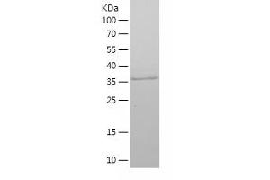 Ki-67 Protein (AA 762-1016) (His tag)