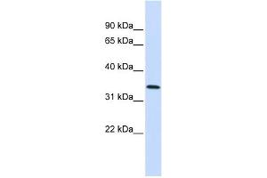 Annexin A4 antibody used at 1 ug/ml to detect target protein. (Annexin IV antibody  (Middle Region))