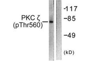 Western blot analysis of extracts from COS7 cells treated with PMA 125ng/ml 30', using PKC zeta (Phospho-Thr560) Antibody. (PKC zeta antibody  (pThr560))