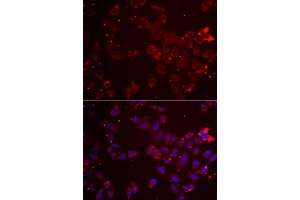 Immunofluorescence analysis of  cells using GATM antibody (ABIN6133283, ABIN6140984, ABIN6140985 and ABIN6222282). (GATM antibody  (AA 124-423))