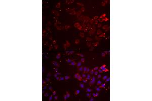 Immunofluorescence analysis of  cells using GATM antibody (ABIN6133283, ABIN6140984, ABIN6140985 and ABIN6222282). (GATM antibody  (AA 124-423))