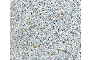 IHC analysis of Grp75 using anti-Grp75 antibody (ABIN7602782). (HSPA9 antibody  (C-Term))