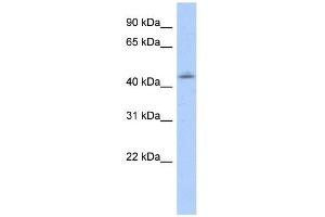 WB Suggested Anti-OTX1 Antibody Titration:  0. (OTX1 antibody  (N-Term))