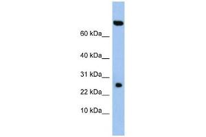 anti-Zinc Finger, SWIM-Type Containing 3 (ZSWIM3) (N-Term) antibody