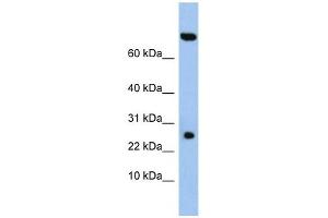 ZSWIM3 antibody used at 1 ug/ml to detect target protein. (ZSWIM3 antibody  (N-Term))