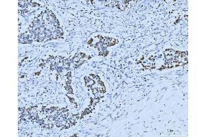 IHC analysis of MCM6 using anti-MCM6 antibody (ABIN7600037).