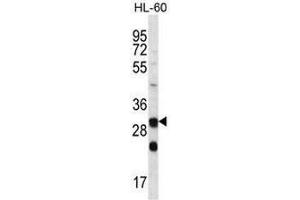 CA6 Antibody (C-term) western blot analysis in HL-60 cell line lysates (35µg/lane).