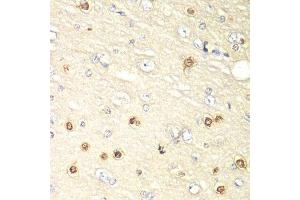 Immunohistochemistry of paraffin-embedded rat brain using HIF1AN antibody. (HIF1AN antibody  (AA 1-349))