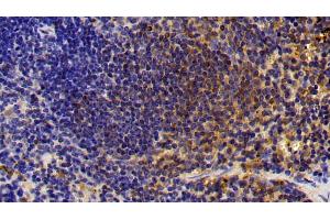 Detection of CTSS in Mouse Spleen Tissue using Polyclonal Antibody to Cathepsin S (CTSS) (Cathepsin S antibody  (AA 115-331))