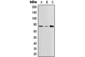 Western blot analysis of SLP76 expression in Jurkat (A), SP2/0 (B), H9C2 (C) whole cell lysates. (LCP2 antibody  (Center))