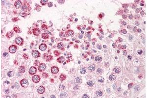 Anti-GAGED2 antibody IHC staining of human testis. (XAGE1D antibody  (AA 58-69))