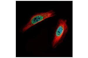 ICC/IF Image Confocal immunofluorescence analysis (Olympus FV10i) of paraformaldehyde-fixed HeLa, using CLIC4, antibody (Green) at 1:500 dilution. (CLIC4 antibody)