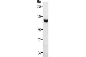 Gel: 8 % SDS-PAGE, Lysate: 40 μg, Lane: Mouse heart tissue, Primary antibody: ABIN7192434(SLC24A1 Antibody) at dilution 1/1000, Secondary antibody: Goat anti rabbit IgG at 1/8000 dilution, Exposure time: 30 minutes (SLC24A1 antibody)