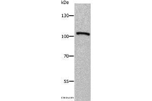 Western blot analysis of Human fetal brain tissue, using ADAMTS5 Polyclonal Antibody at dilution of 1:650