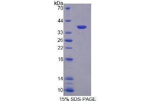 SDS-PAGE (SDS) image for Oxytocin Receptor (OXTR) (AA 43-129) protein (His tag,GST tag) (ABIN1080442)