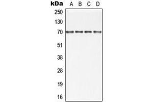 Western blot analysis of cIAP1 expression in HT29 (A), Jurkat (B), SP2/0 (C), PC12 (D) whole cell lysates. (BIRC2 antibody  (Center))