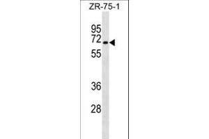 SG Antibody (C-term) (ABIN1537484 and ABIN2849754) western blot analysis in ZR-75-1 cell line lysates (35 μg/lane). (C9orf96 antibody  (C-Term))