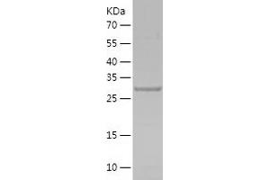 Western Blotting (WB) image for Insulin-Like Growth Factor Binding Protein 7 (IGFBP7) (AA 27-282) protein (His tag) (ABIN7287320) (IGFBP7 Protein (AA 27-282) (His tag))