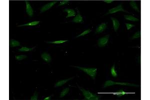 Immunofluorescence (IF) image for anti-Carbohydrate (Chondroitin 6) Sulfotransferase 3 (CHST3) (AA 312-411) antibody (ABIN522944)
