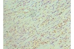 Immunohistochemistry of paraffin-embedded human epityphlon tissue using ABIN7147161 at dilution of 1:100 (CD48 antibody  (AA 27-125))