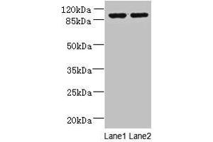 Western blot All lanes: EFHB antibody at 4 μg/mL Lane 1: HepG2 whole cell lysate Lane 2: PC-3 whole cell lysate Secondary Goat polyclonal to rabbit IgG at 1/10000 dilution Predicted band size: 94, 71, 80 kDa Observed band size: 94 kDa (EFHB antibody  (AA 405-644))