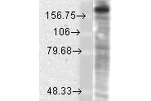 Western Blot analysis of Rat brain membrane lysate showing detection of GluN2B/NR2B protein using Mouse Anti-GluN2B/NR2B Monoclonal Antibody, Clone S59-36 . (GRIN2B antibody  (AA 20-271) (APC))