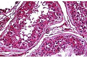 Human Testis: Formalin-Fixed, Paraffin-Embedded (FFPE) (PDK2 antibody  (AA 187-276))