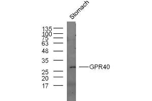 Mouse stomach lysates probed with GPR40 Polyclonal Antibody, unconjugated  at 1:300 overnight at 4°C followed by a conjugated secondary antibody at 1:10000 for 60 minutes at 37°C. (FFAR1 antibody  (AA 121-220))