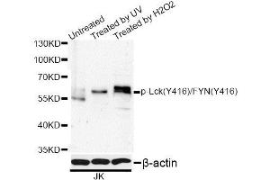 Western blot analysis of extracts of Jurkat cells, using Phospho-Lck-Y416/FYN-Y416 antibody (ABIN5995591) at 1/1000 dilution. (LCK antibody  (pTyr416))