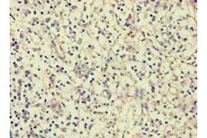 Immunohistochemistry of paraffin-embedded human spleen tissue using ABIN7144082 at dilution of 1:100 (AGGF1 antibody  (AA 1-70))