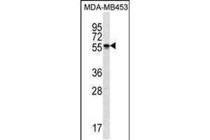 Western blot analysis in MDA-MB453 cell line lysates (35ug/lane). (SOHLH2 antibody  (AA 232-258))
