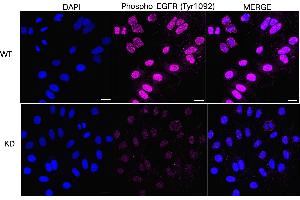 Immunocytochemical staining of HepG2 cells using Phospho-EGFR (Tyr) antibody (ABIN7798465), 1:1,000), Top panel: wild-type (WT), Bottom panal: Phospho-EGFR (Tyr) shRNA knockdown (KD). (Recombinant EGFR antibody  (pTyr1068))