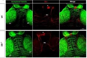 Whole-mount immunofluorescence on 6 dpf dissected brains. (DCC antibody  (Middle Region))