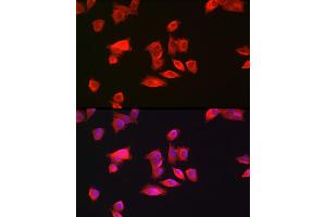 Immunofluorescence analysis of Hep G2 cells using GAMT Rabbit pAb (ABIN6130447, ABIN6140950, ABIN6140951 and ABIN6222280) at dilution of 1:200 (40x lens).