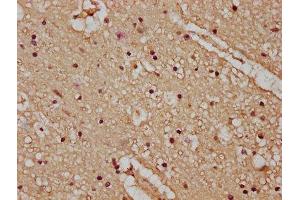 IHC image of ABIN7163520 diluted at 1:100 and staining in paraffin-embedded human brain tissue performed on a Leica BondTM system. (ATP2B4 antibody  (AA 281-345))