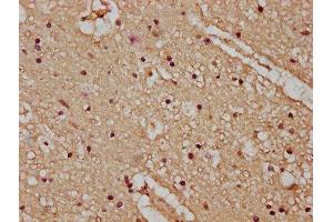 IHC image of ABIN7163520 diluted at 1:100 and staining in paraffin-embedded human brain tissue performed on a Leica BondTM system.