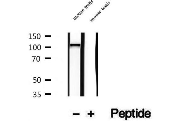 NAT10 antibody  (Internal Region)