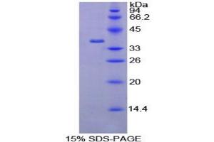 SDS-PAGE analysis of Rat AATF Protein. (AATF Protein)