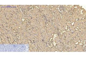 Immunohistochemistry of paraffin-embedded Rat kidney tissue using ACTA2 Monoclonal Antibody at dilution of 1:200. (Smooth Muscle Actin antibody)