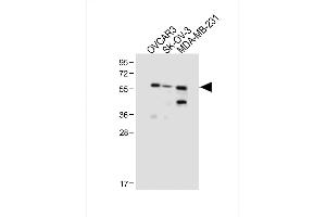 All lanes : Anti-HR2 Antibody (N-term) at 1:1000 dilution Lane 1: OVCAR3 whole cell lysate Lane 2: SK-OV-3 whole cell lysate Lane 3: MDA-MB-231 whole cell lysate Lysates/proteins at 20 μg per lane. (AMHR2 antibody  (N-Term))