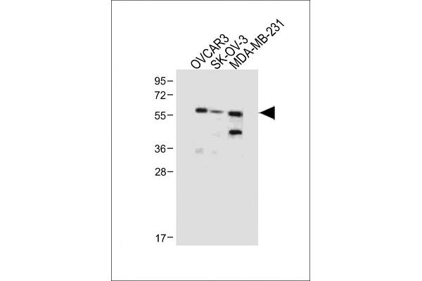 AMHR2 antibody  (N-Term)