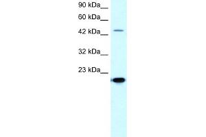 WB Suggested Anti-MMAntibody Titration:  5. (MMP19 antibody  (C-Term))
