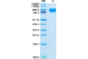CD177 Protein (AA 26-516) (His tag)