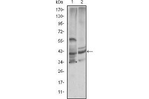 Western blot analysis using CST3 mouse mAb against Hela (1) and Caco-2 (2) cell lysate. (CST3 antibody)