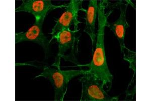 ICC/IF staining of HeLa cells treated with sodium butyrate using recombinant H3K56ac antibody (red). (Recombinant Histone 3 antibody  (H3K56ac))