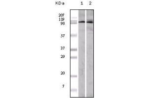 Western blot analysis using EphA1 antibody against A549 (1) and Hela (2) cell lysate. (EPHA1 antibody)